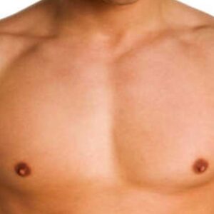 Borsthaar laseren - Laser ontharen - Huidzorg Klinieken