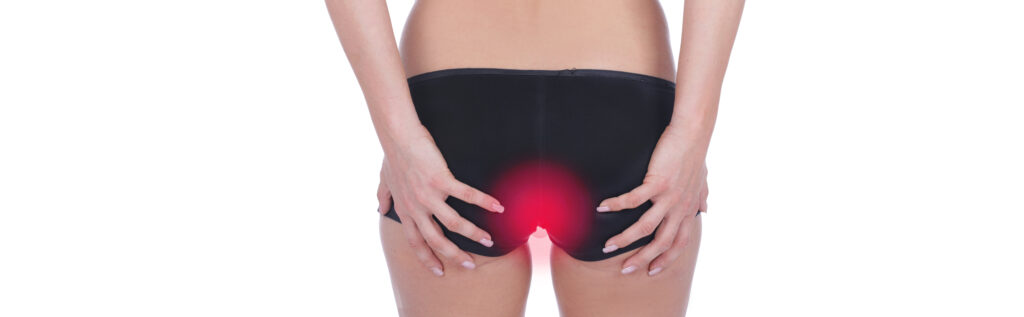 Laserontharing bij sinus pilonidalis ter ondersteuning van behandeling en vermindering van recidief