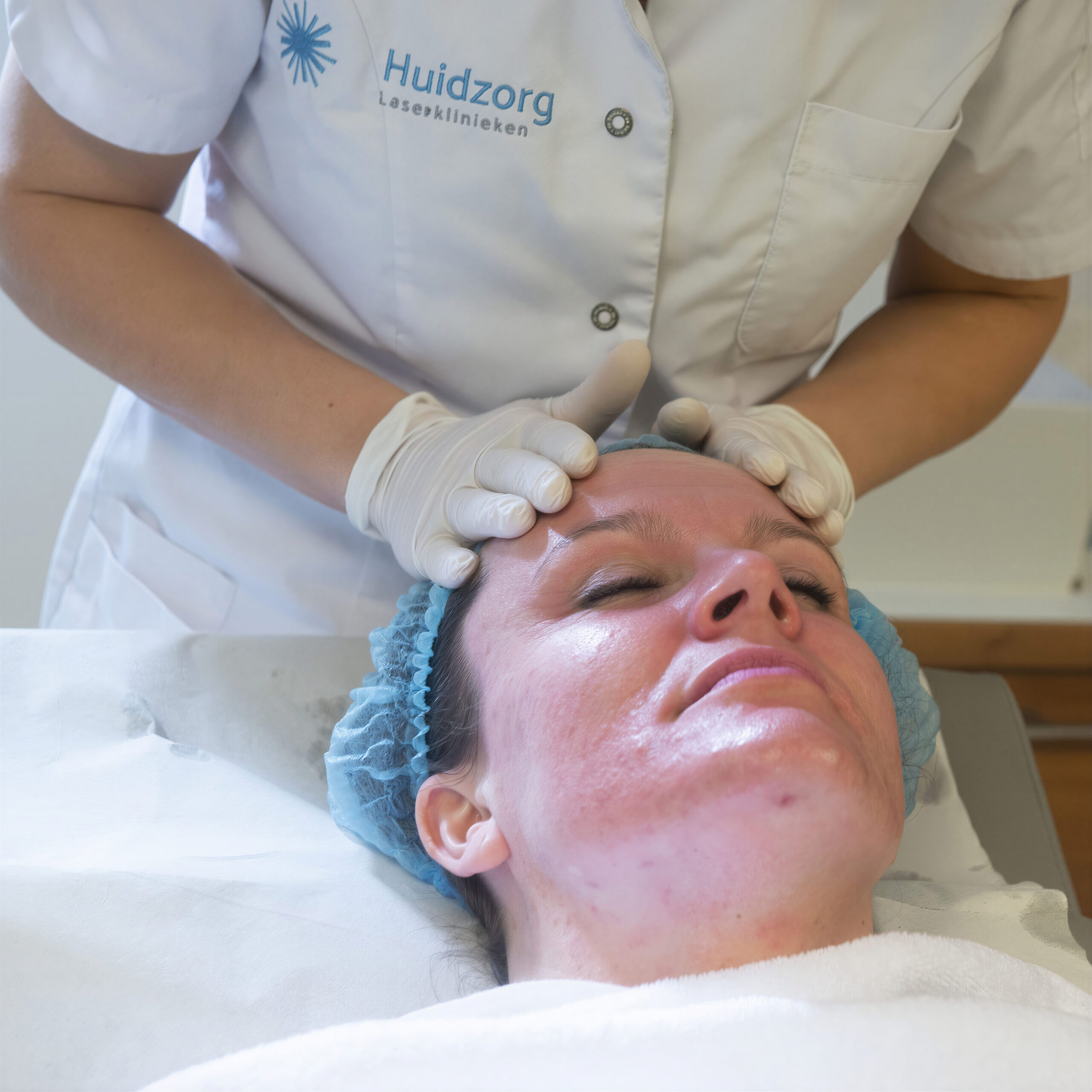 Behandeling van rosacea met focus op het verminderen van roodheid en het kalmeren van de huid